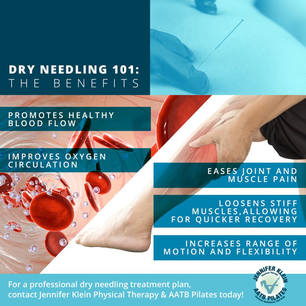 What is Dry Needling? Professional Physical Therapy Houston