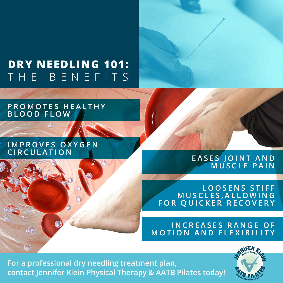 Dry Needling  Inspire Health
