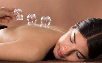 What Is Cupping Therapy? Does It Work?