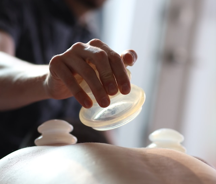 cupping 2 Performing cupping therapy