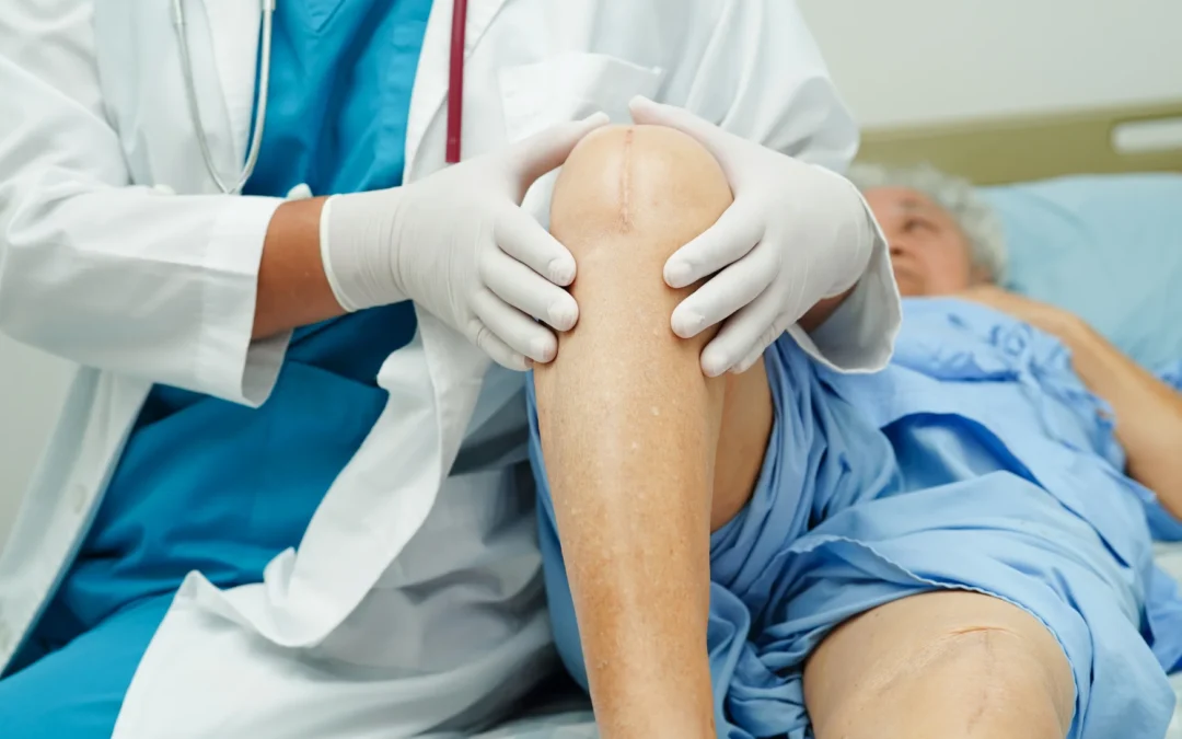 Knee Replacement Recovery Timeline: What to Expect Week by Week